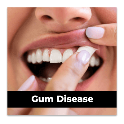 نیکوتین خوراکی مکیدنی مرکبات ZYN Citrus Nicotine Pouches